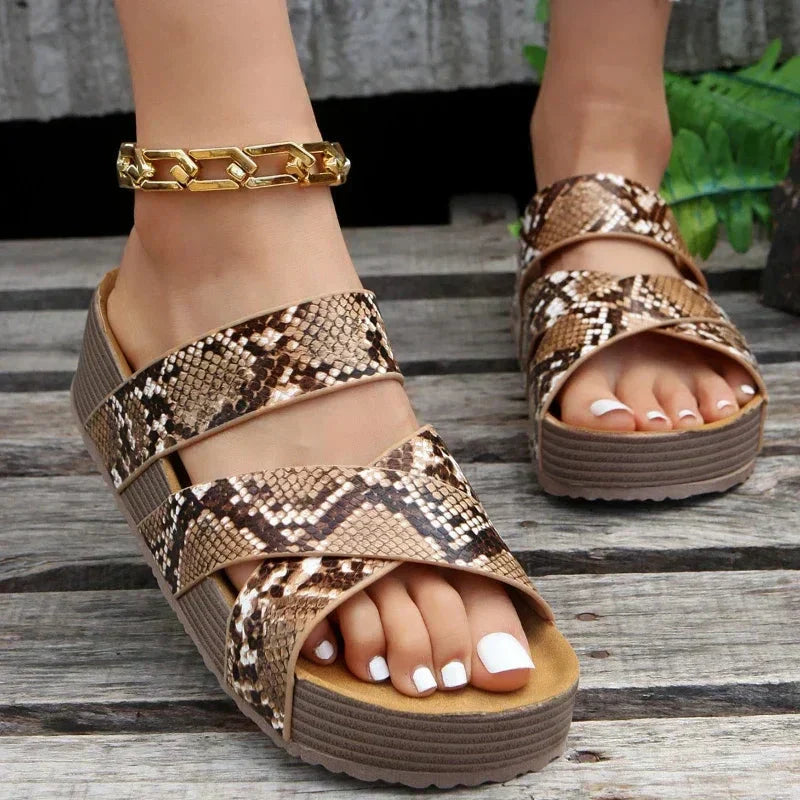 Naya™ | Sandalias Ortopédicas – Comodidad Inigualable para Tus Pies